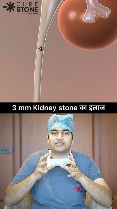 3 Mm Kidney Stone