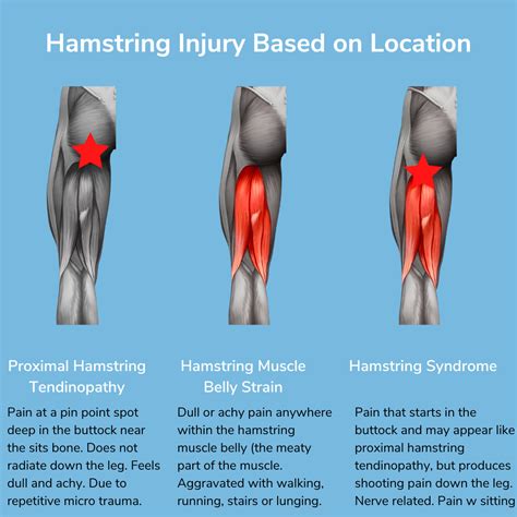 Ache In Hamstring