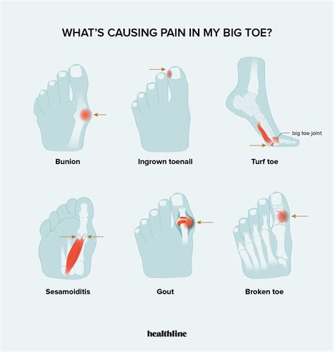 Aching Big Toe
