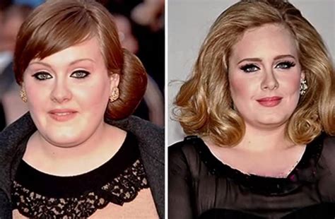 Adele Before After