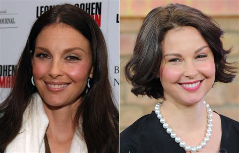 Ashley Judd Face Surgery