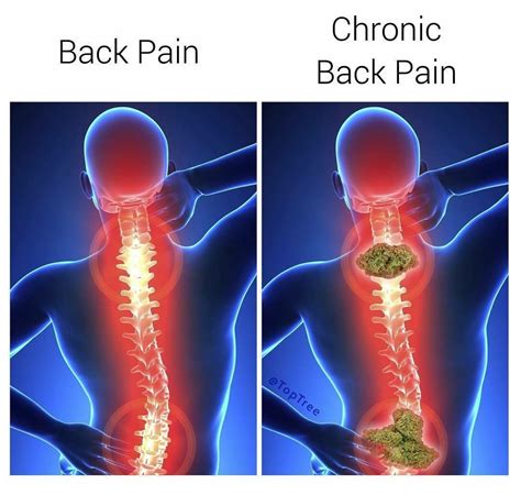 Back Pain Meme
