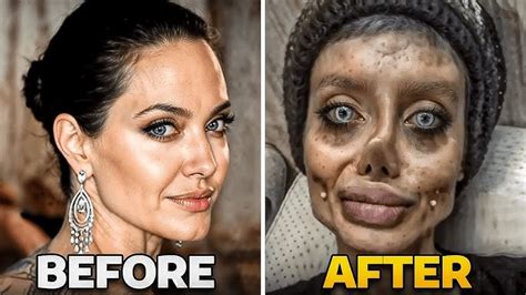 Bad Face Surgery