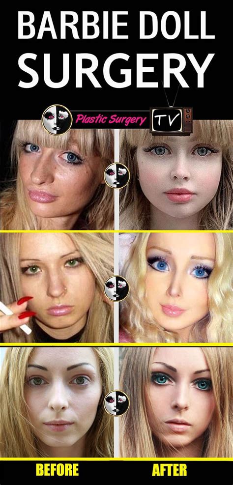Barbie Face Surgery