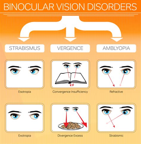 Binocular Vision Dysfunction