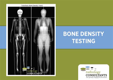 Bone Density Test Cost