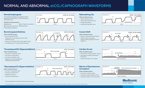 Capnography Waveforms