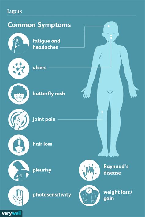 Childhood Lupus Symptoms Signs