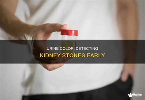 Color Of Urine Kidney Stones