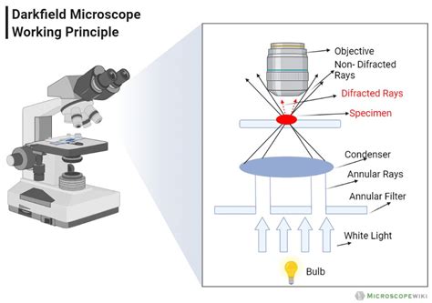 Dark Field Microscopy