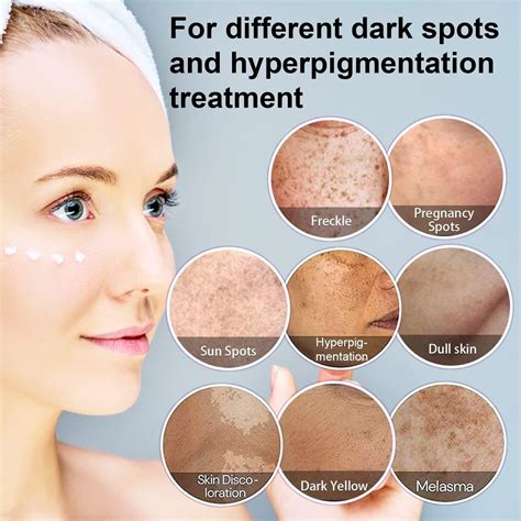 Dark Spots Medication