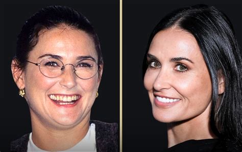 Demi Moore Face Surgeries