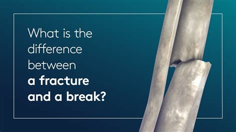 Difference Between Fracture And Break