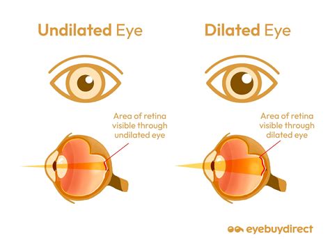 Dilate Eyes Meaning