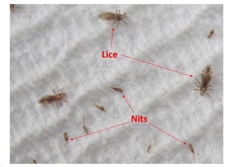 Do Lice Fly