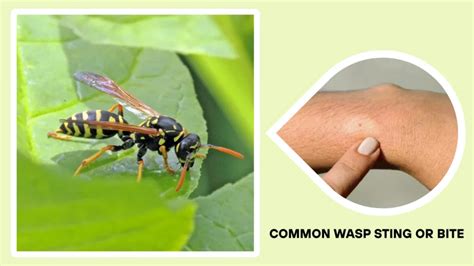 Do Wasps Bite