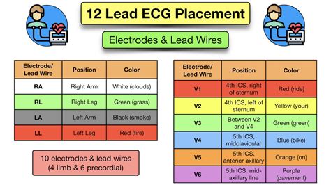 Ecg Leads Explained