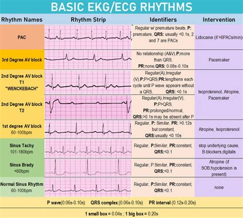 Ekg Rhythms