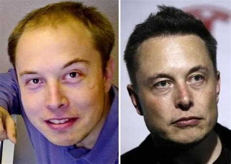 Elon Musk Before Face Surgery