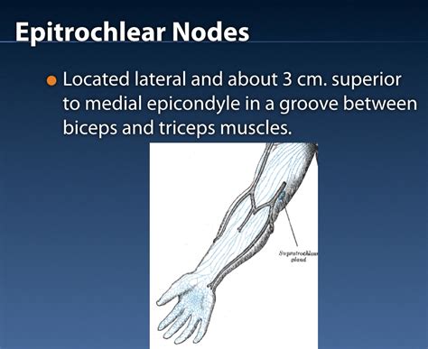 Epitrochlear Lymph Nodes