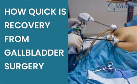 Female Gallbladder Surgery Recovery Time
