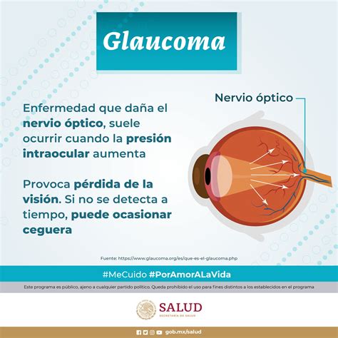 Glaucoma Que Es