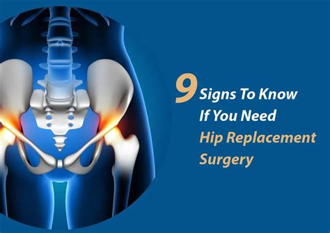 Hip Replacement Symptoms