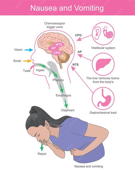 How To Suppress Vomiting