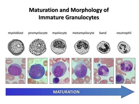 Immature Granulocytes Abs