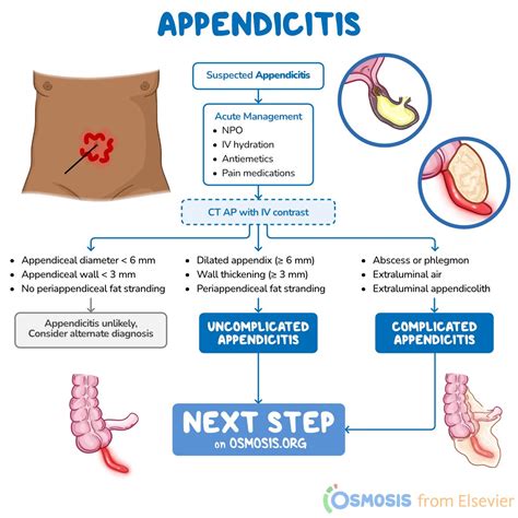 Is Appendicitis Genetic