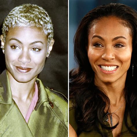 Jada Pinkett Smith Face Surgery