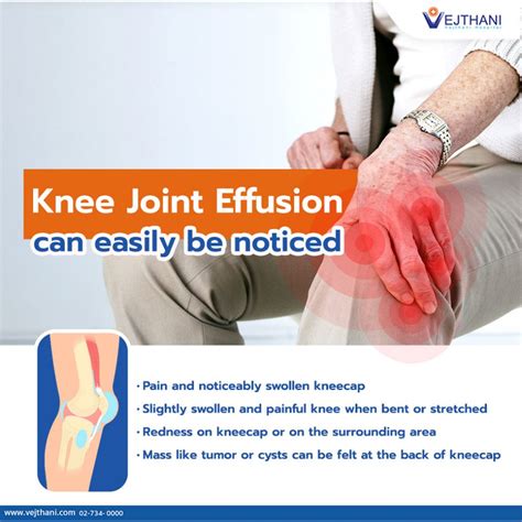Knee Effusion Treatment