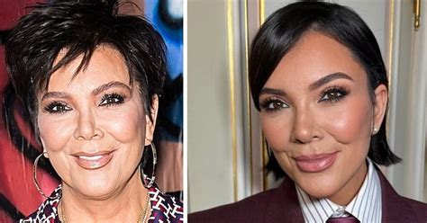Kris Jenner Face Surgery