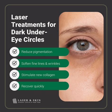 Laser For Dark Circles