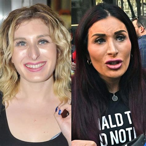 Laura Loomer Face Plastic Surgery