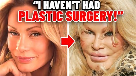 Lion Face Plastic Surgery