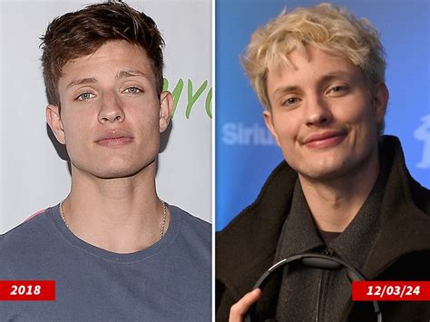 Matt Rife Face Surgery