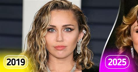 Miley Cyrus Face Surgery 2025
