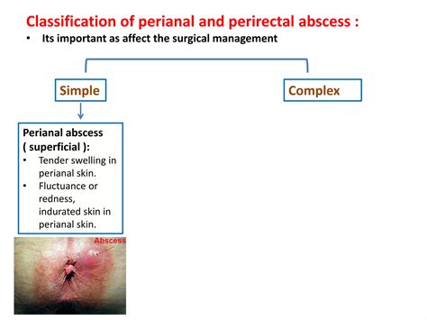 Perianal Abscesses Causes