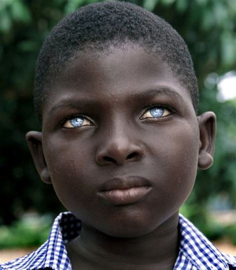 Person With Blue Eyes
