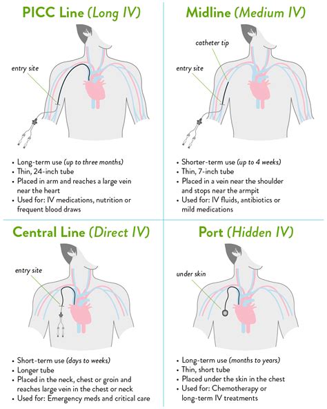 Picc Line Insertion