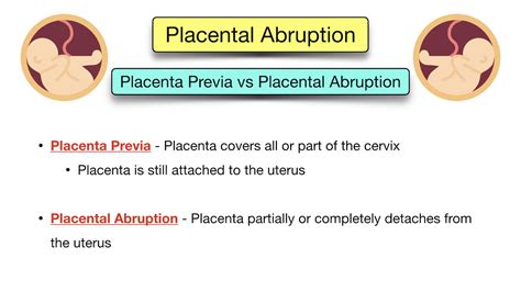 Placenta Previa Vs Abruptio Placenta