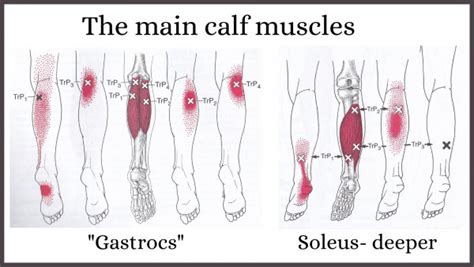 Pop In Calf Muscle
