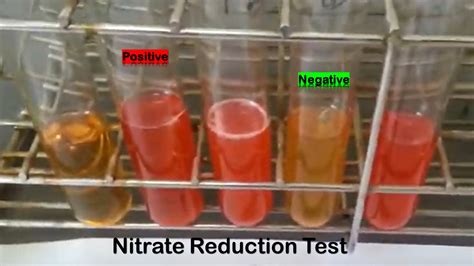 Positive Nitrite Test