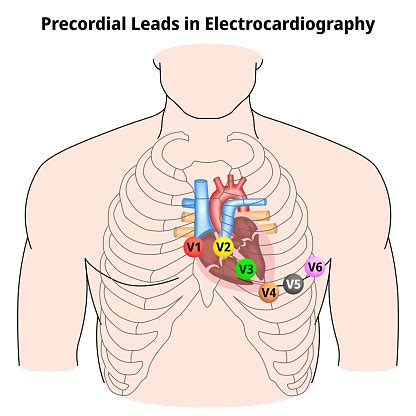 Precordial Leads