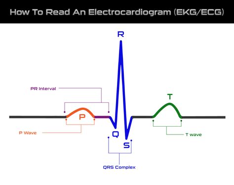 Reading An Ekg