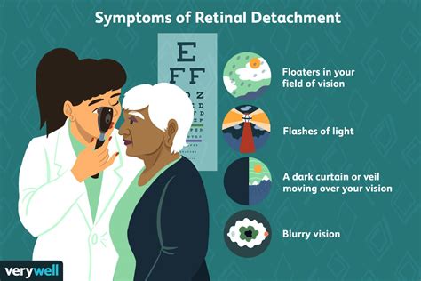 Retinal Detachment Symptoms