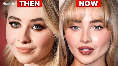 Sabrina Carpenter Face Surgery