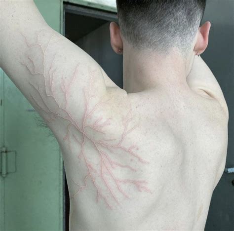 Scars From Lightning