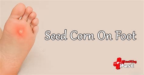 Seed Corn On Foot